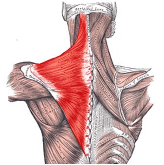 Lower Trapezius Tendon Transfer