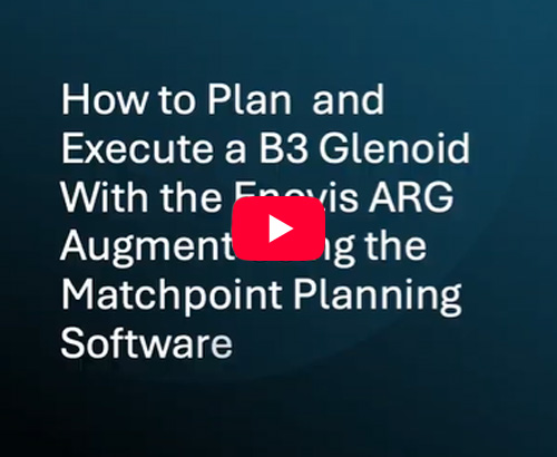 Reverse Shoulder Arthroplasty for Severe B3 Glenoid Bone Loss